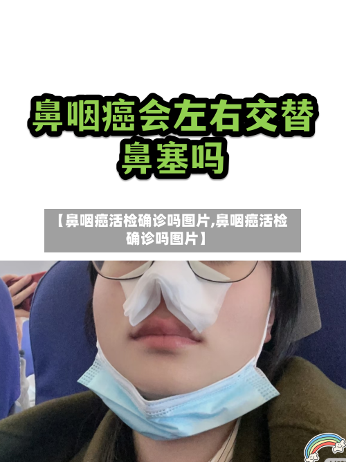 【鼻咽癌活检确诊吗图片,鼻咽癌活检确诊吗图片】