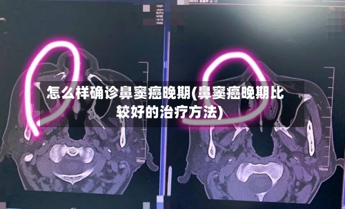 怎么样确诊鼻窦癌晚期(鼻窦癌晚期比较好的治疗方法)-第2张图片