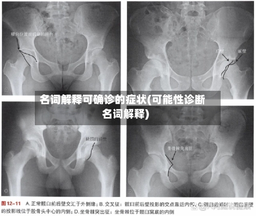 名词解释可确诊的症状(可能性诊断名词解释)