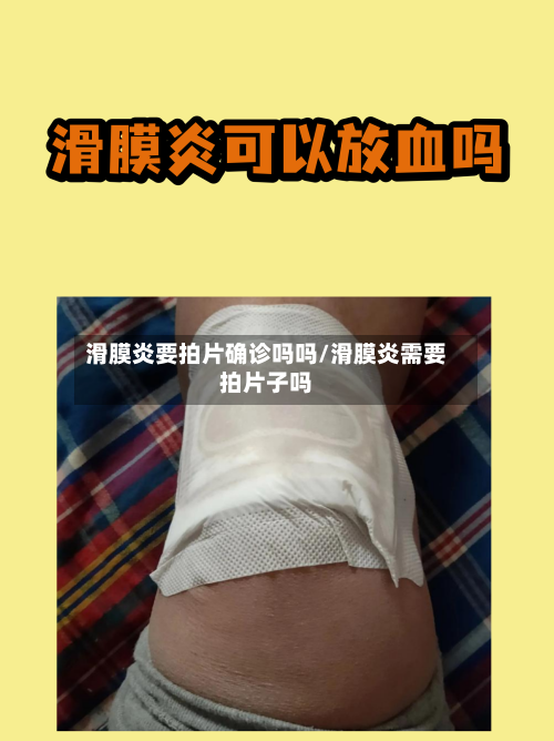 滑膜炎要拍片确诊吗吗/滑膜炎需要拍片子吗-第2张图片