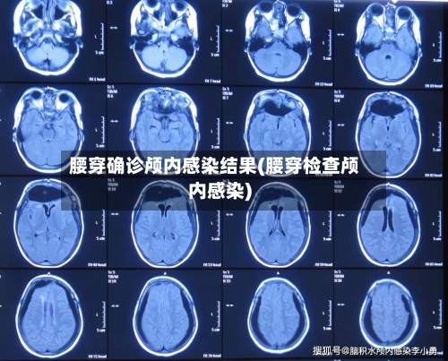 腰穿确诊颅内感染结果(腰穿检查颅内感染)-第2张图片