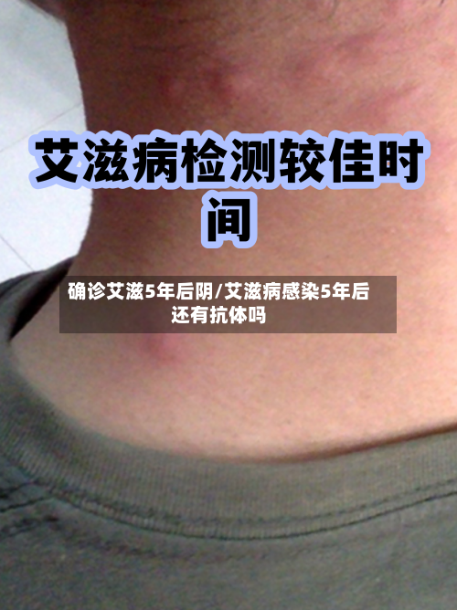 确诊艾滋5年后阴/艾滋病感染5年后还有抗体吗-第2张图片