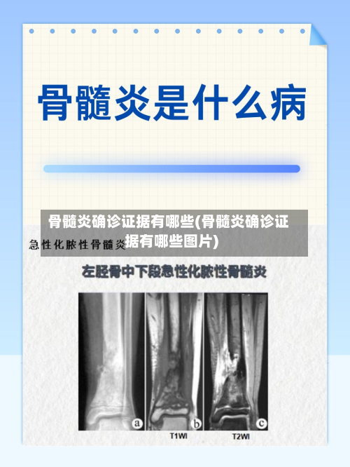 骨髓炎确诊证据有哪些(骨髓炎确诊证据有哪些图片)-第2张图片