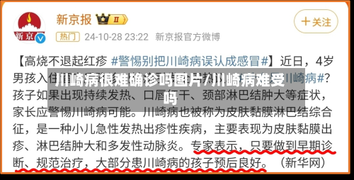 川崎病很难确诊吗图片/川崎病难受吗